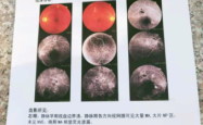 赤峰市医院眼科电话号码是多少