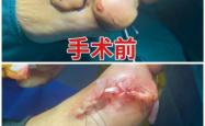 赤峰痛风康复中心电话多少号