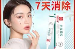 赤峰红山区点痣店电话号码