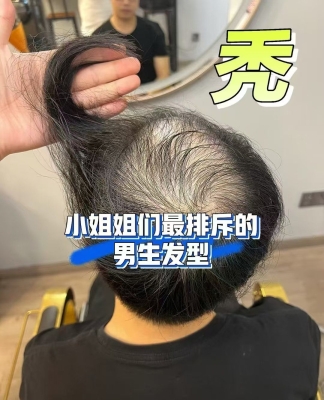 赤峰唐风采定制假发电话地址-第1张图片