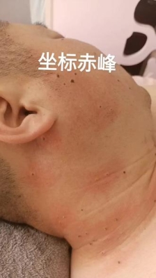 赤峰亮颜美业电话号码查询-第1张图片