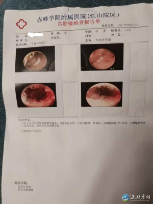赤峰平民医院咨询电话号码是多少-第1张图片