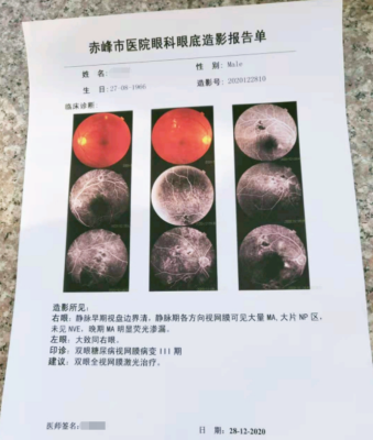赤峰市医院眼科电话号码是多少-第1张图片