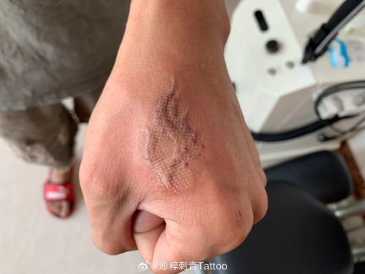 赤峰乌丹纹身店电话多少号-第1张图片